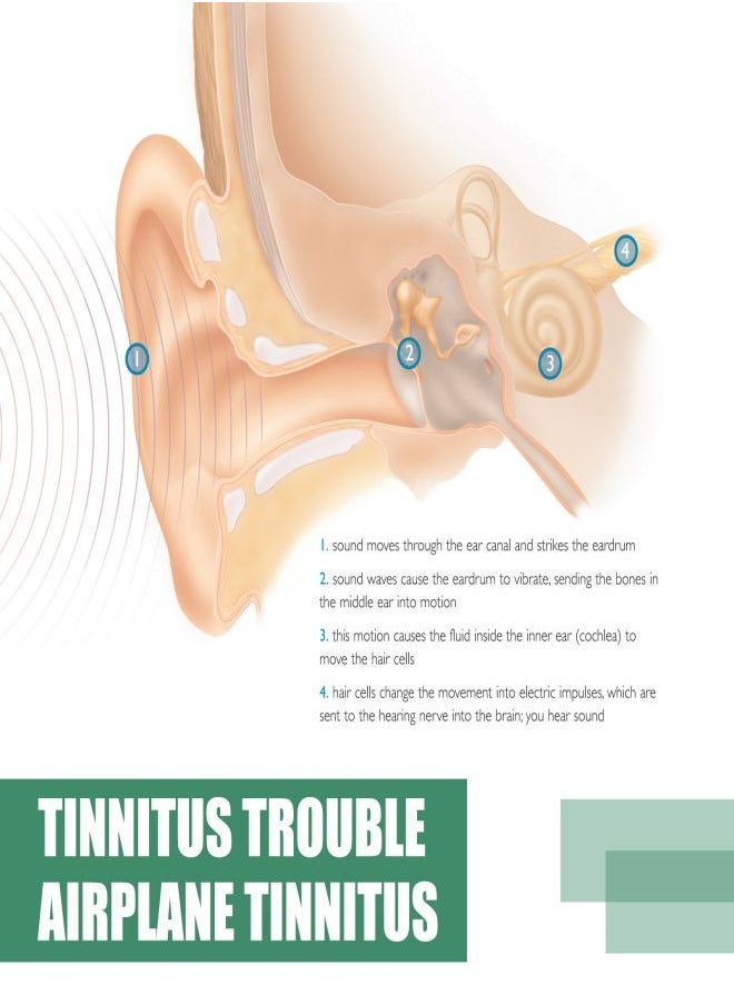 SOUTH MOON Tinnitus Relief and Remedies Natural Treatment  - Image 3
