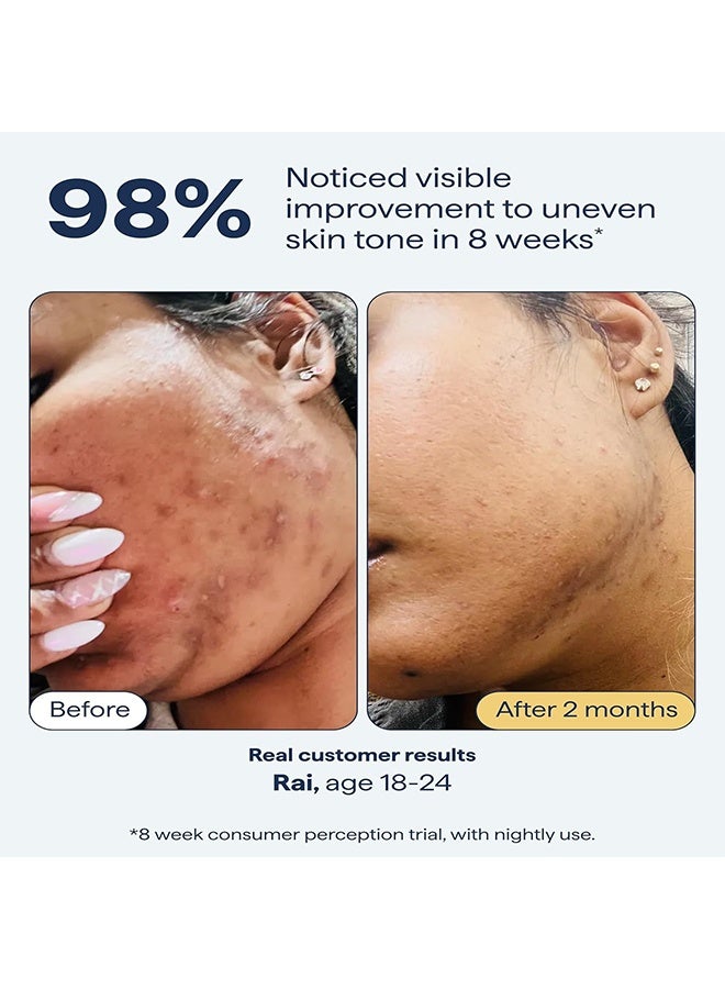 هويجي سيروم للبقع الداكنة وعلاج التصبغات للوجه يحتوي على رتينول، جلووتاثيون، نياكيناميد، حمض الماندليك، حمض الكوجيك وحمض الترانيكساميك، 30 مل - Image 4