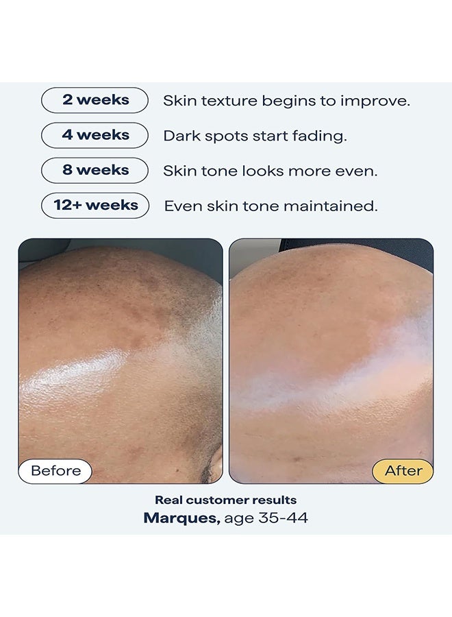 هويجي سيروم للبقع الداكنة وعلاج التصبغات للوجه يحتوي على رتينول، جلووتاثيون، نياكيناميد، حمض الماندليك، حمض الكوجيك وحمض الترانيكساميك، 30 مل - Image 5