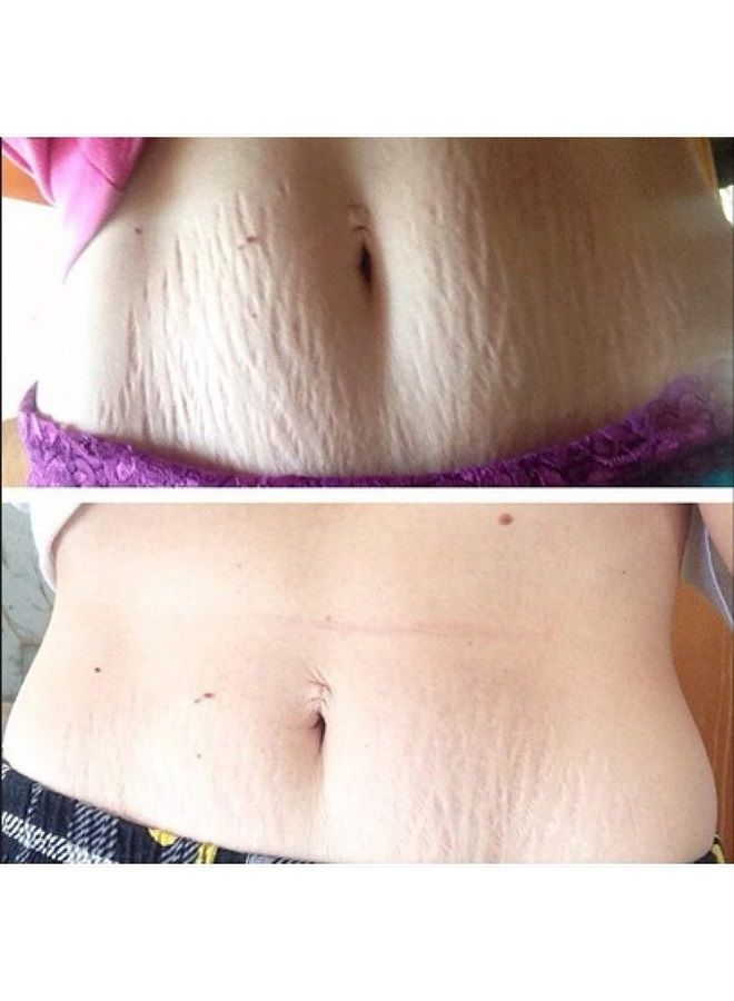 frank body مقشر القهوة الأصلي - Image 5