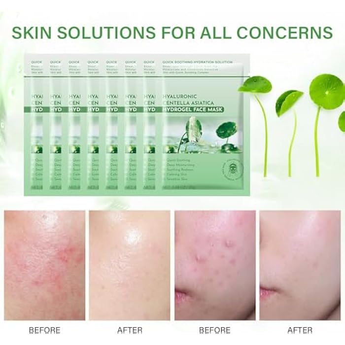 IREV Calming Mask for Face, Centella Asiatica Calming Mask, Facial Masks with Aloe Hyaluronic Acid for Sensitive Skin,Soothing,Anti Aging Face Mask,Face Masks Skincare,Hydrating Sheet Facial Masks 10 pack - Image 4