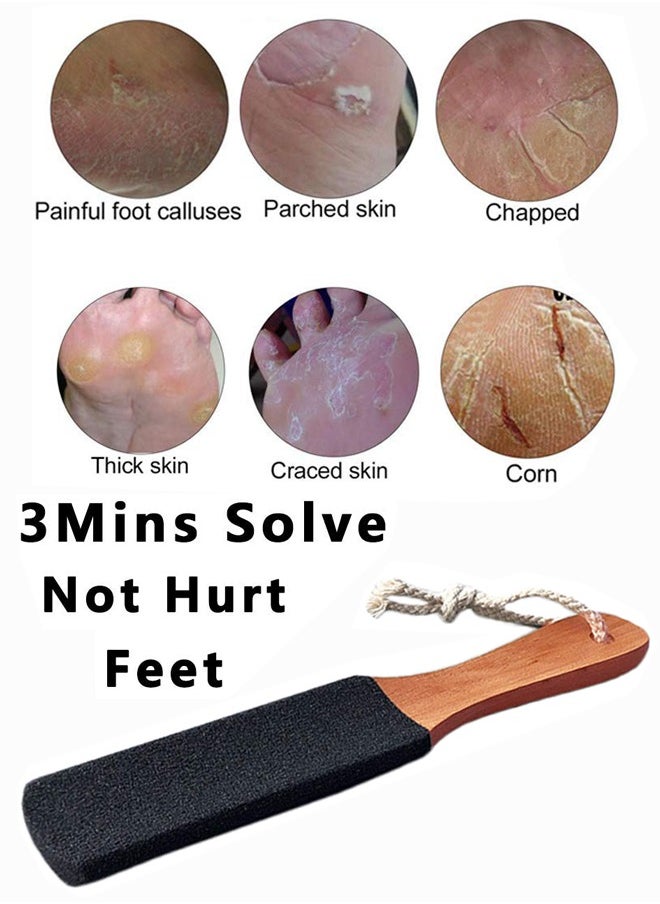 BONITO 2PCS Foot File Callus Remover Foot Scrubber,Professional Pedicure Foot Rasp Removes Cracked Heels,Dead,Hard Skin  - Image 2