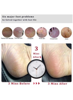 BONITO 2PCS Foot File Callus Remover Foot Scrubber,Professional Pedicure Foot Rasp Removes Cracked Heels,Dead,Hard Skin  - Image 5