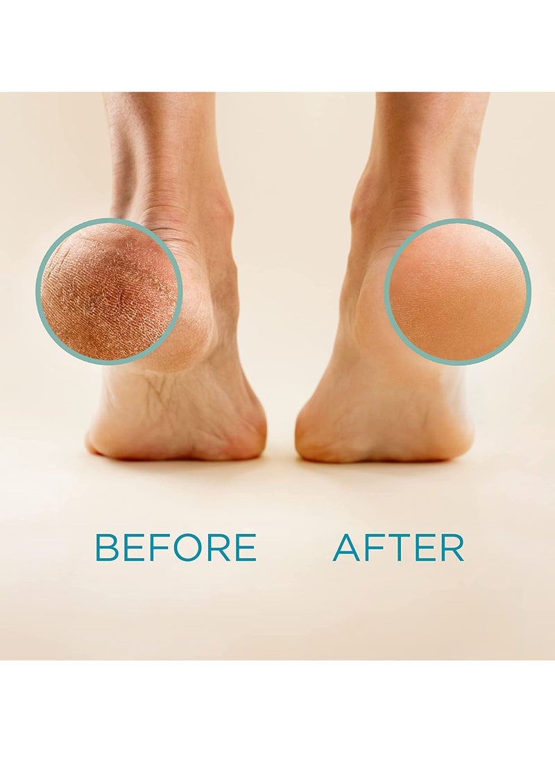 Silky Cool Silky Cool Callus Remover Gel 250 Ml - Healthy Feet  - Image 4