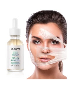 MOOYAM 40% Citric Acid Peeling Serum Chemical Peel for Face Peeling Solution Skin Peel Chemical Exfoliant for Face Exfoliating Facial Peel for Dark Skin Dark Spots Acne Spot 30ml  - Image 2