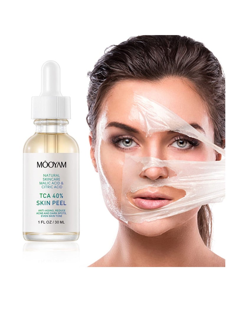 MOOYAM - 40% Citric Acid Peeling Serum Chemical Peel for Face Peeling Solution Skin Peel Chemical Exfoliant for Face Exfoliating Facial Peel for Dark Skin Dark Spots Acne Spot 30ml - Image 1