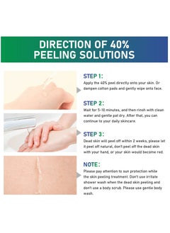 MOOYAM 40% Citric Acid Peeling Serum Chemical Peel for Face Peeling Solution Skin Peel Chemical Exfoliant for Face Exfoliating Facial Peel for Dark Skin Dark Spots Acne Spot 30ml  - Image 4