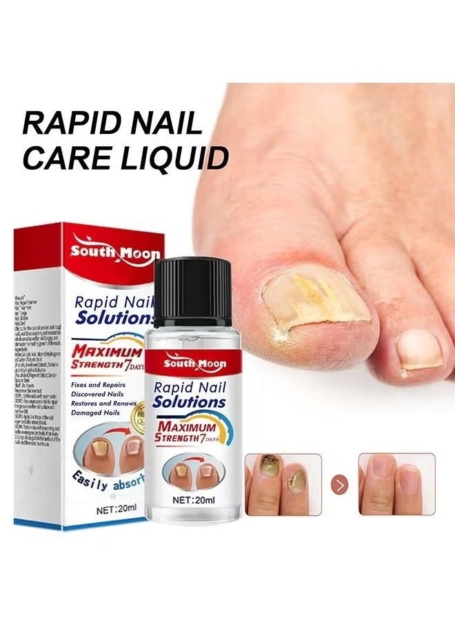 SOUTH MOON Rapid Nail Care Liquid - Fungal Nail Treatment For Toe Nail And Fingernails For Thick/Broken/Discolored Nails - Renews Damaged Cracked Ingrown Toenail - Image 1