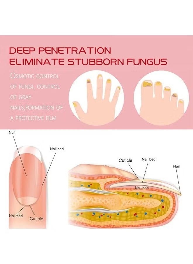 SOUTH MOON Rapid Nail Care Liquid - Fungal Nail Treatment For Toe Nail And Fingernails For Thick/Broken/Discolored Nails - Renews Damaged Cracked Ingrown Toenail - Image 4