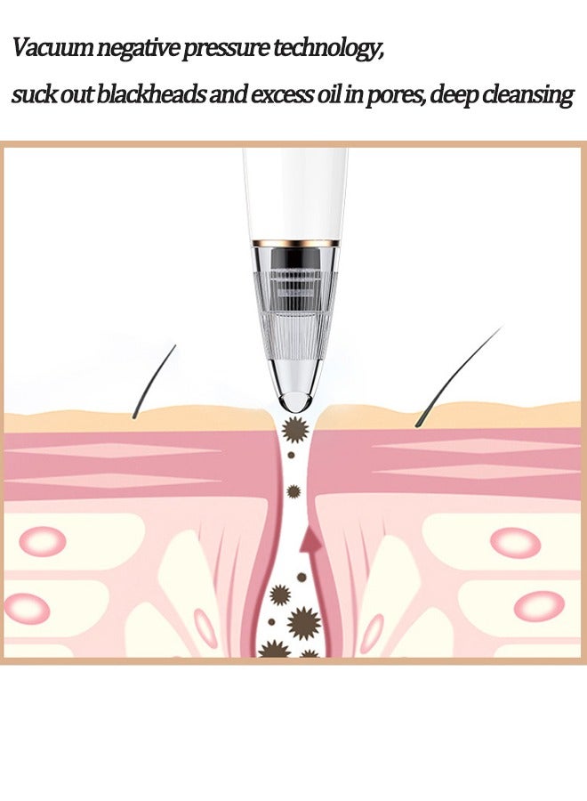 Gasin Powerful Electric Blackhead Remover Instrument White  - Image 2