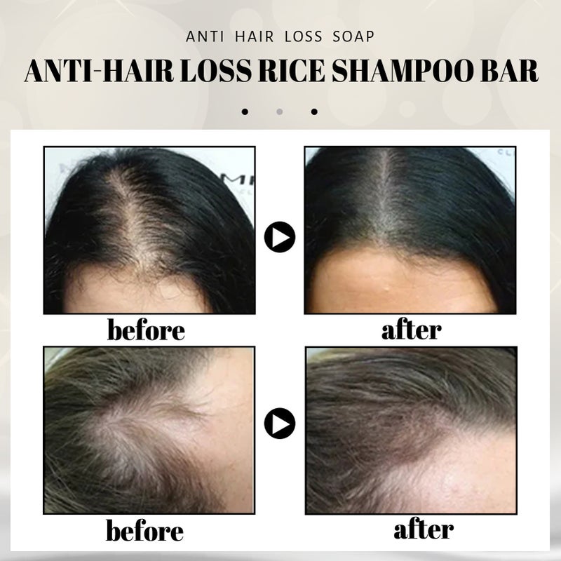 EELHOE 80g Anti-hair Loss Citrus Scent Shampoo Bar Rice Essence Hair Soap Stimulate Hair Growth - Image 2