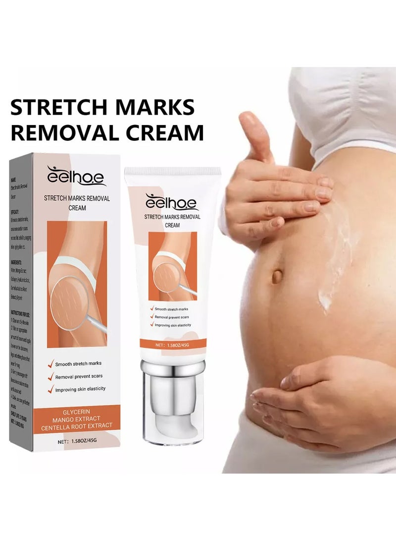 EELHOE Dermease Stretchmarks Removal Cream, Stretch Mark Removal Cream, Stretch Mark Scar Cream, Scar Cream Gel, Scar Care Cream, Help with Stretch Marks, Surgery, Injury, and Burns Scars - Image 2