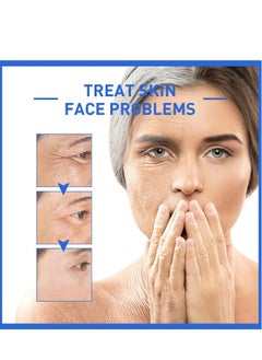 West&Month Botox Stock Solution Facial Serum,Botox Facial Serum for Women,Vitamin C Serum & Collagen Face Serum for Reducing Fine Lines & Wrinkles,Nourishing and Plump Skin 30ml  - Image 3