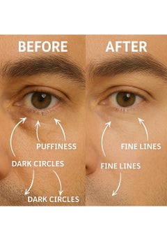 Disco Disco Men's Eye Bag Treatment, Roller Serum for Men, Under Eye Cream Natural Caffeine Anti Aging Stick Balm, Reduce Puffiness, Wrinkles, Dark Circles, Crows Feet, Bags, Dark Circles, Lines, Puffiness  - Image 4