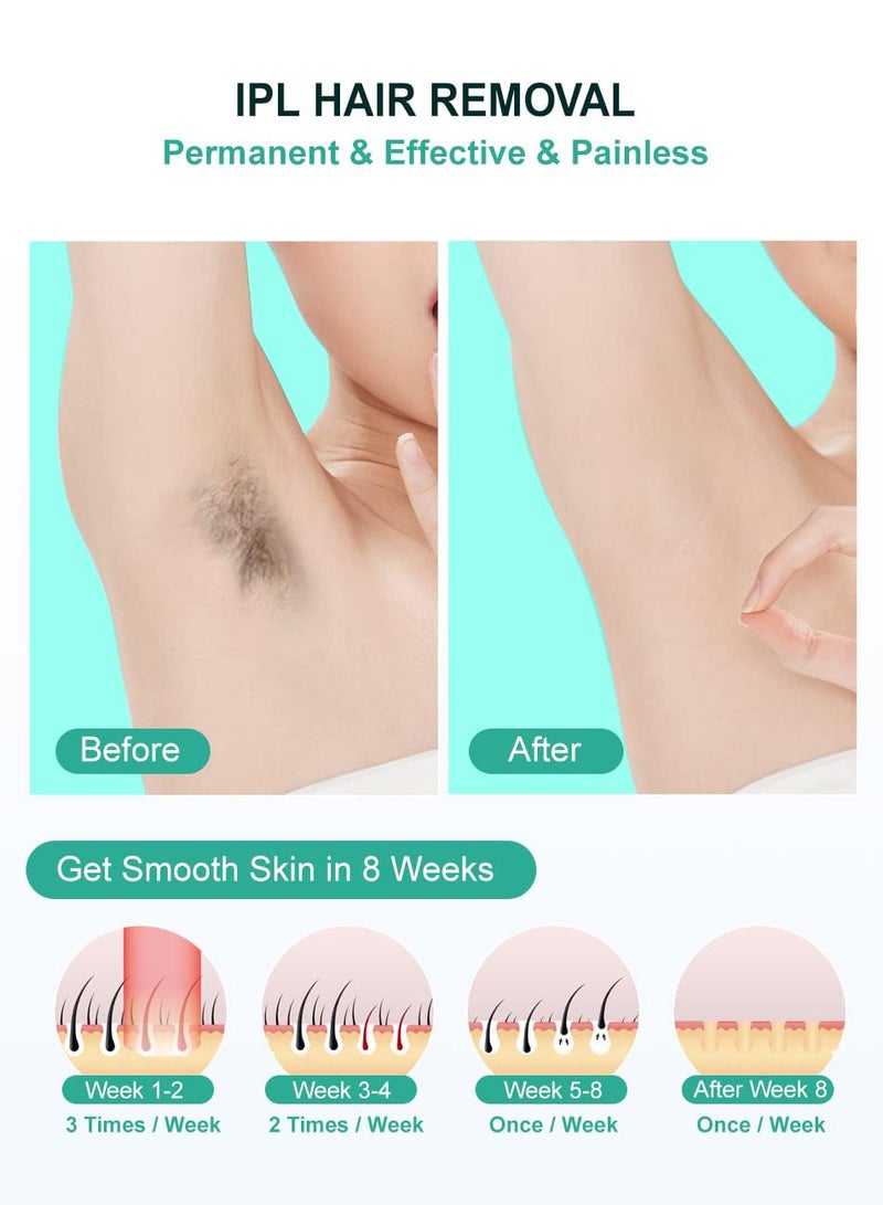 جهاز إزالة الشعر بالليزر IPL لإزالة الشعر بالليزر للنساء والرجال، 999,9999 ومضة لإزالة الشعر الدائم على الوجه والساقين والذراعين وخط البيكيني - Image 4