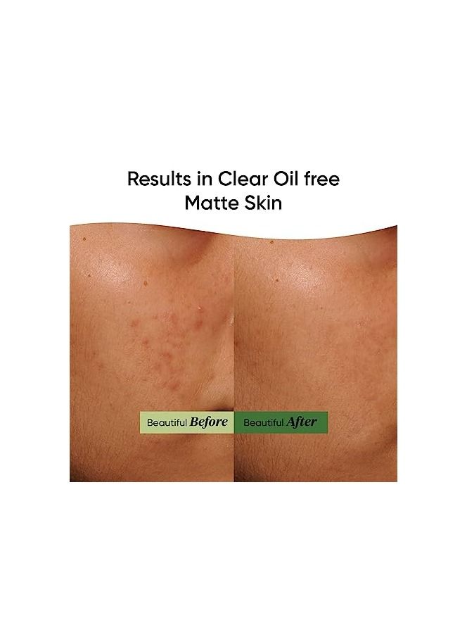 دوت آند كي جل ليلي لتهدئة البشرة من دوت آند كي سيكا    60ml - Image 5