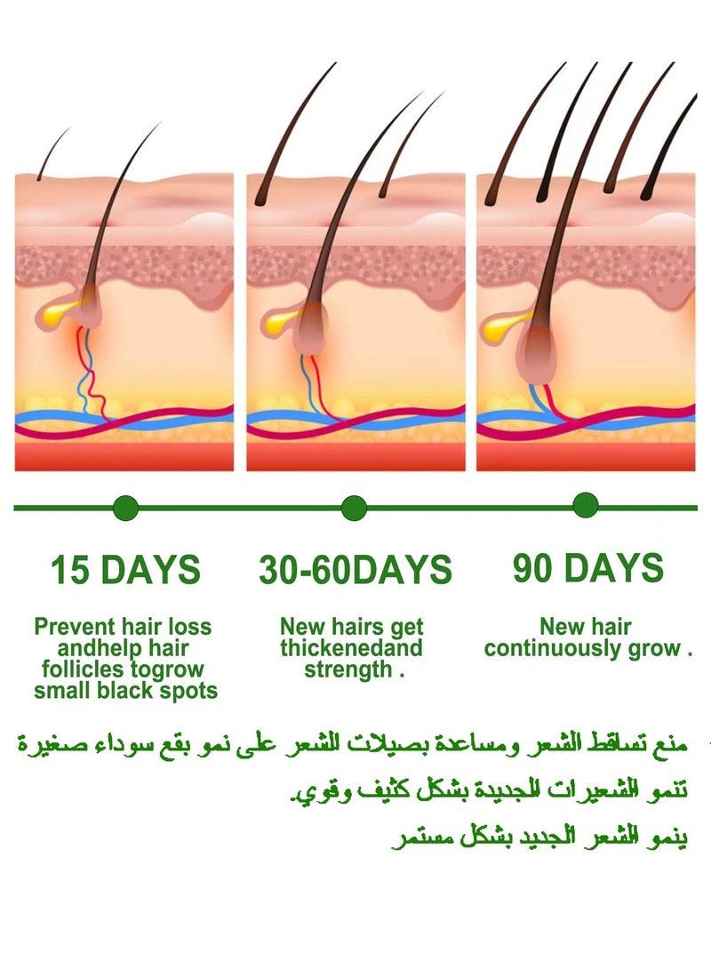 EELHOE Rosemary Essential Oils Rosemary Oil for Hair Growth Serum, Pure Organic Rosemary Oil for Dry Damaged Hair and Growth, Hair Loss Scalp Treatment, Skin Care，For Hair Growth Hair Care(30ml) - Image 2