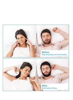 SYOSI Anti Snoring Chin Strap Adjustable and Breathable Devices, Snore Stopper Breather Mouth Closed While Sleeping Suitable Men Women Better Sleep  - Image 4