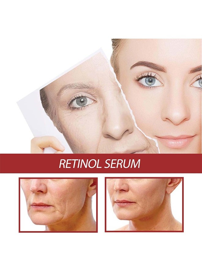 EELHOE Retinol Serum - Retinol Face Serum For Anti Wrinkle, Dark Spot Serum For Brightening And Rejuvenating Skin - Hyaluronic Acid Serum With Retinol & Hydrolyzed Collagen, Anti Aging, Moisturize 30ml  - Image 5