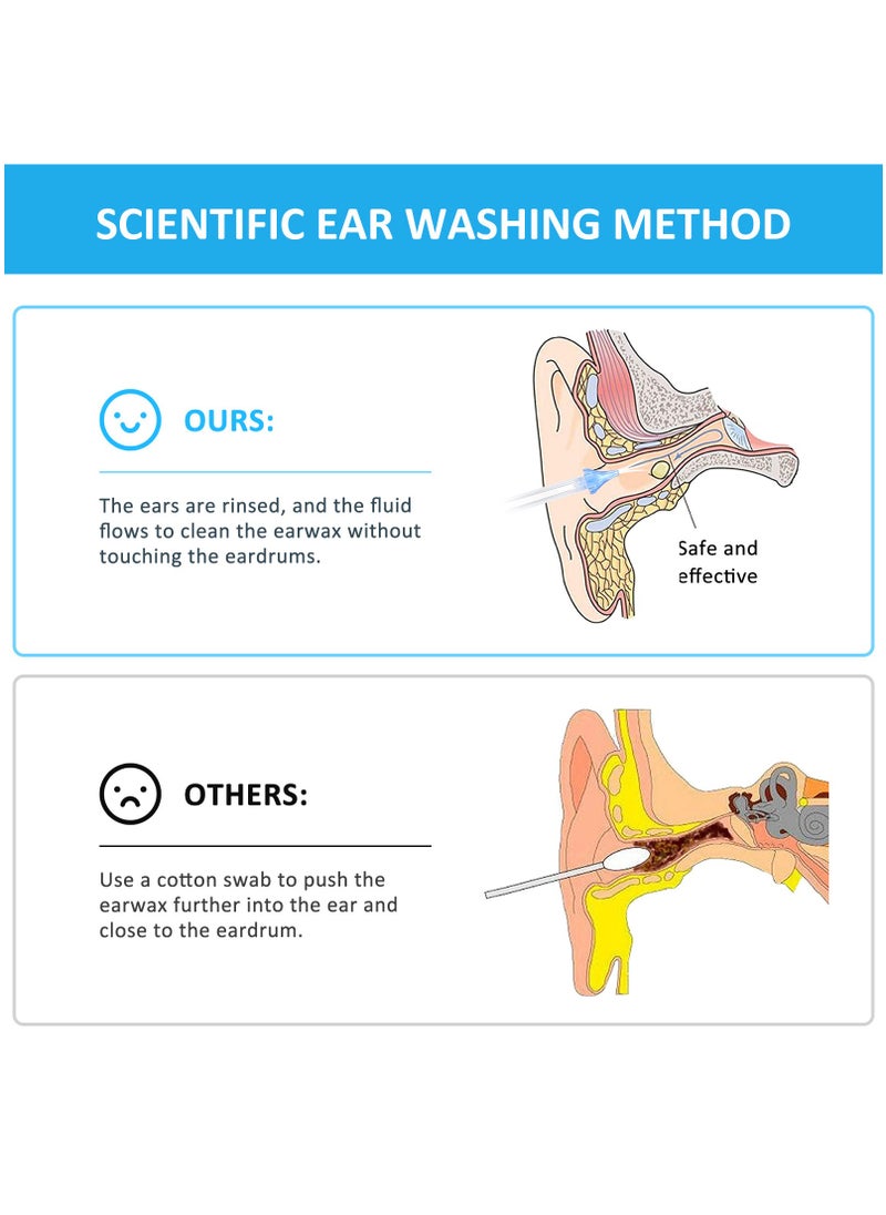 XiuWoo Water Ear Wax Removal Kit, Ear Cleaner, Ear Wax Remover, Ear Irrigation, Ear Syringe Kit Tools, Cerumen Control with Replaceable Tips, Quad-Stream Tips for Ear Clean, Ear Syringe Tools  - Image 3
