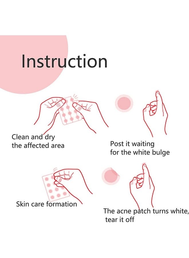 Spanking Dots For Spots Pimple Patches Acne Pimple Hydrocolloid Patches 0.05Mm Ultrathin Breathable Invisible Blemish Spot Three Sizes 72 Patches - Image 3