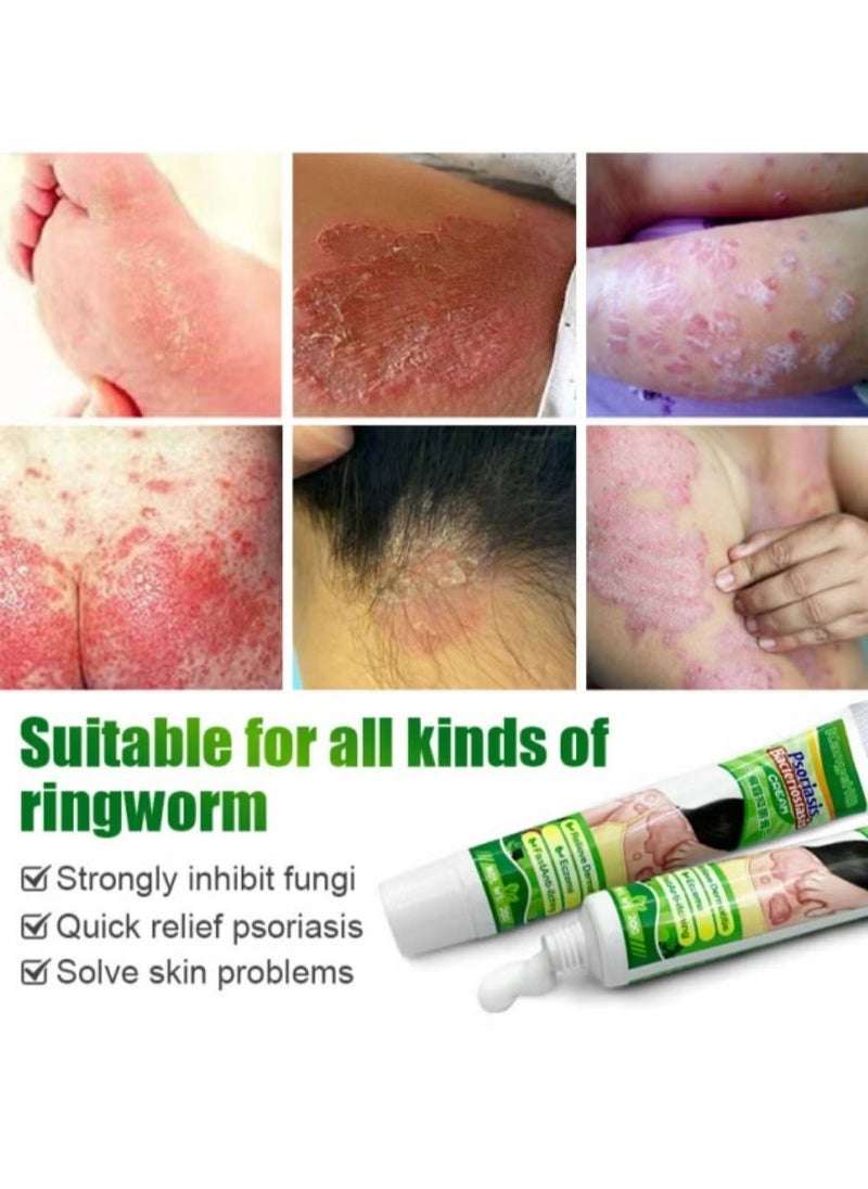KanyeHB - Antibacterial Cream for Psoriasis and Eczema Antifungal Cream, Helps Eczema, Ringworm Anti-Itch Cream with Gentler and Safer Herbal Ingredients Quickly Relives Itching for Face & Body - Image 1