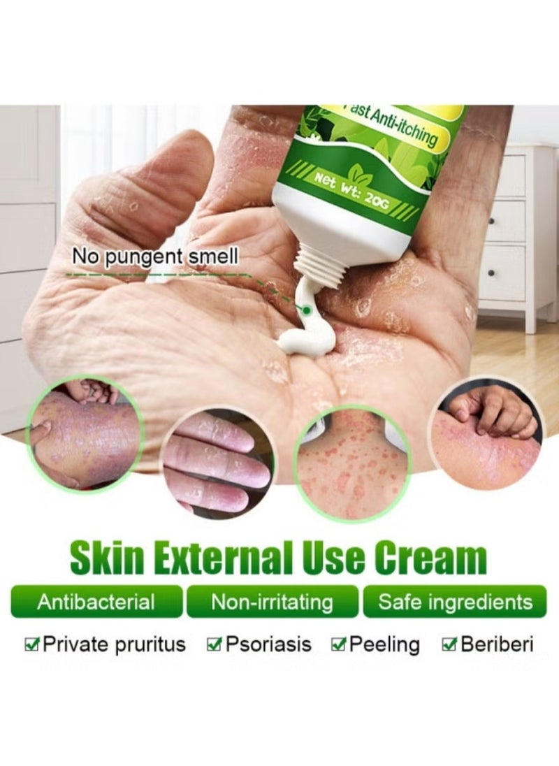 KanyeHB - Antibacterial Cream for Psoriasis and Eczema Antifungal Cream, Helps Eczema, Ringworm Anti-Itch Cream with Gentler and Safer Herbal Ingredients Quickly Relives Itching for Face & Body - Image 1