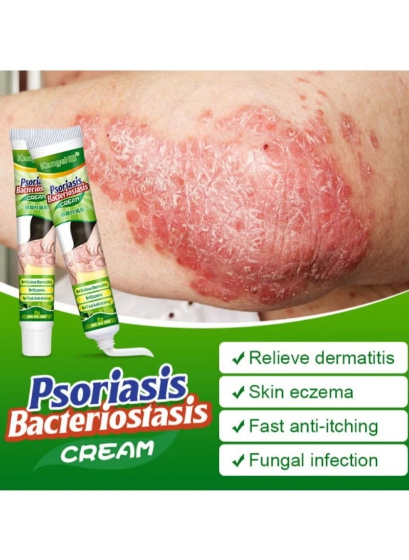 KanyeHB - Antibacterial Cream for Psoriasis and Eczema Antifungal Cream, Helps Eczema, Ringworm Anti-Itch Cream with Gentler and Safer Herbal Ingredients Quickly Relives Itching for Face & Body - Image 1