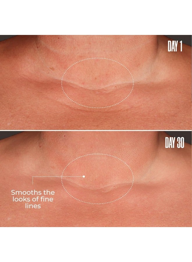 Maelys MAËLYS B-GLOSSY Smoothing Body Serum - Anti-Aging Hyaluronic Acid Serum for Body Wrinkles - Hydrating Serums with Peptides & Shea Butter To Smooth The Appearance Of Wrinkles - 2 Pack - Image 4