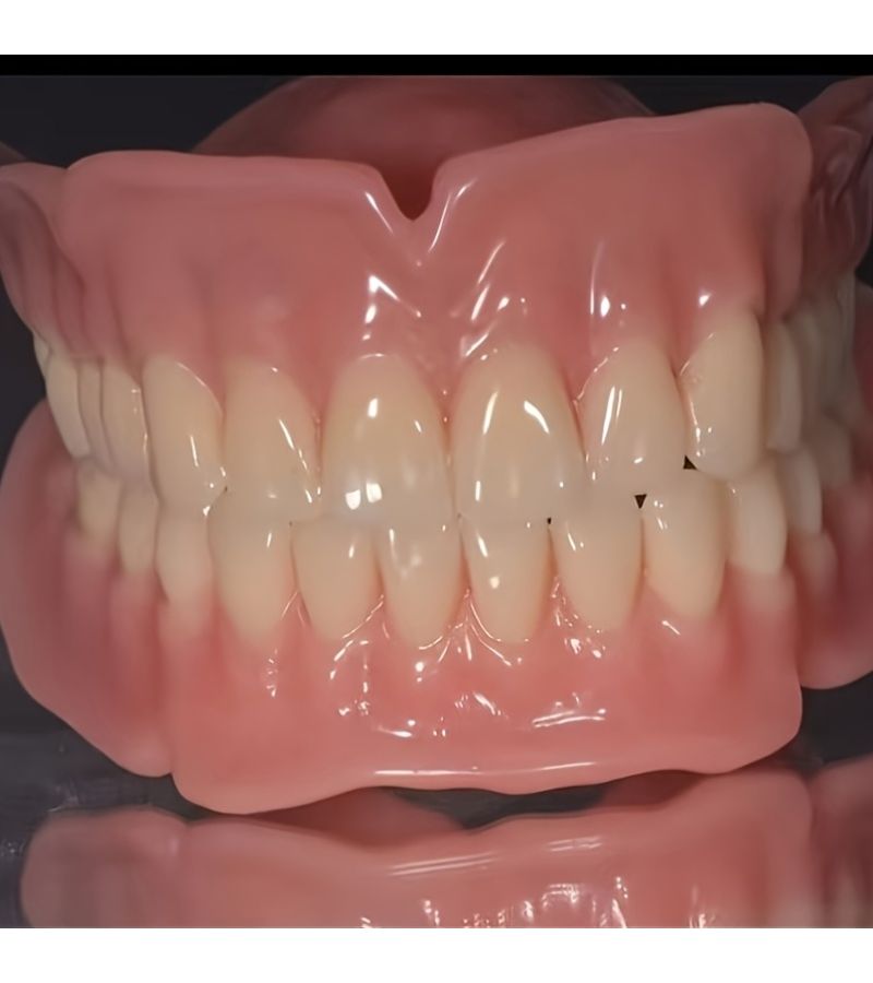 Natural Look Unisex Denture Set 1 Box Upper Lower Easy Install Comfort Fit - Image 1