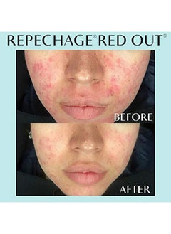 Repechage Hydra 4 Red Out Serum With Microsilver + Quercetin Skin Calming And Soothing Relief Face Serum 1 Fl Oz  - Image 3