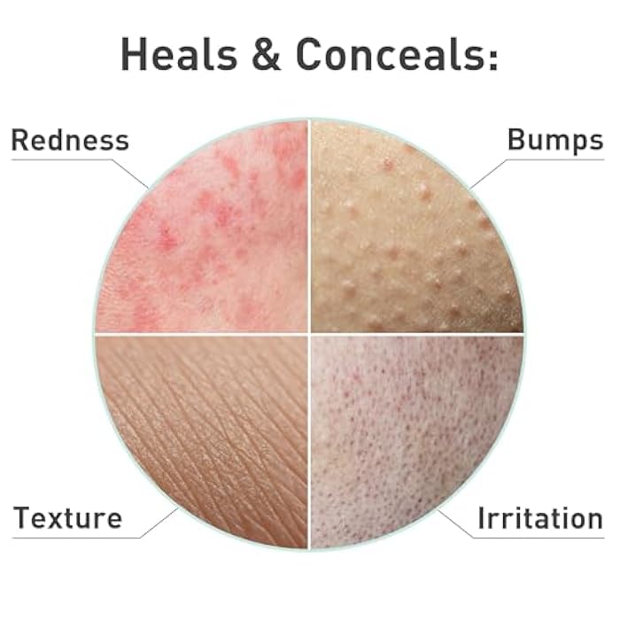 Procure Rosacare Sheet Face Mask - 5 Pack - Image 5