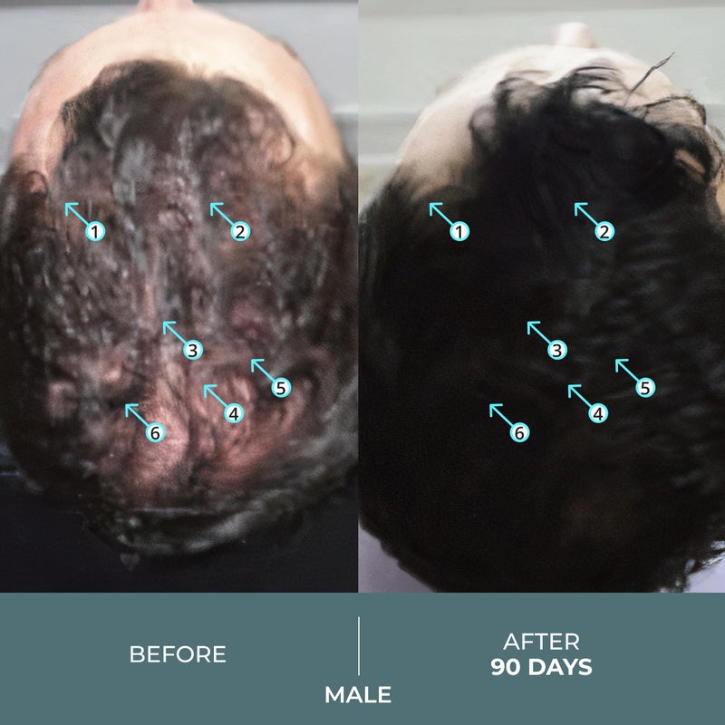 DS LABORATORIES DS Labs Spectral Booster (formerly Spectral.F7) Hair Density Serum, 60mL - Non-Greasy, Leave-In, Supports Fuller, Thicker, Looking Hair, with Astressin-B Peptide & Copper Peptides, Water-Based - Image 3