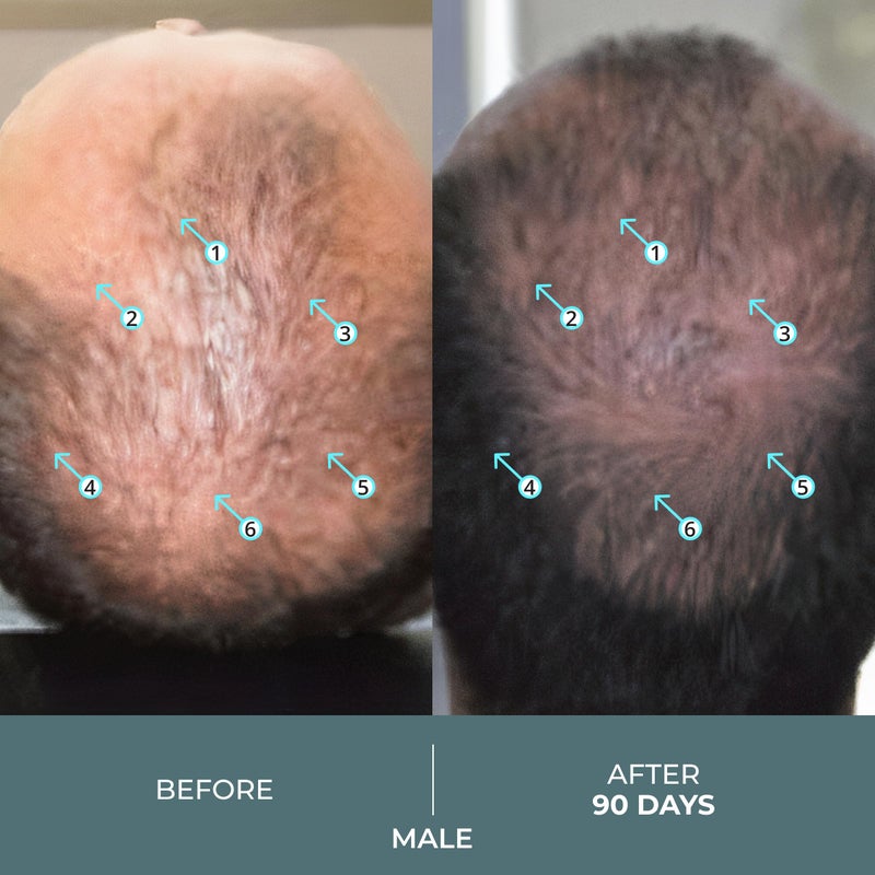 DS LABORATORIES DS Labs Spectral Booster (formerly Spectral.F7) Hair Density Serum, 60mL - Non-Greasy, Leave-In, Supports Fuller, Thicker, Looking Hair, with Astressin-B Peptide & Copper Peptides, Water-Based - Image 4