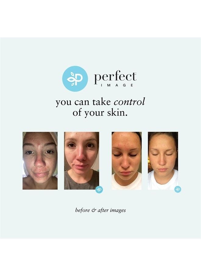 PERFECT IMAGE - Glycolic Acid 30% Gel Peel - Enhanced with Retinol and Green Tea Extract (Professional Chemical Peel)- 1 fl oz 30mL - Image 1