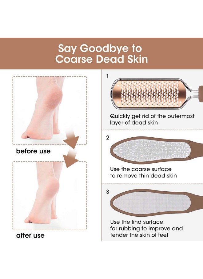 Oneleaf - 2Pcs Professional Pedicure Rasp Foot File Cracked Skin Corns Callus Remover For Extra Smooth And Beauty Foot (Black) (Rose) - Image 1