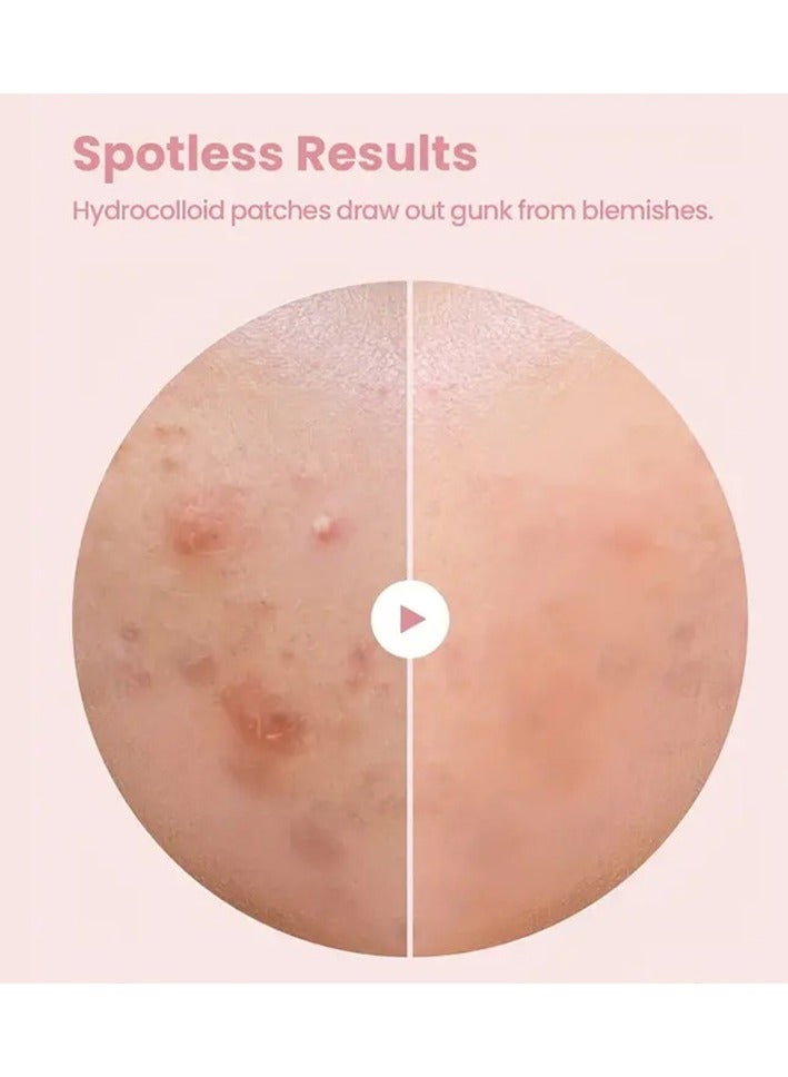 Acne patch 432 Count Pimple Patch, Acne Covering Stickers For Face And Skin, For Men And Women Daily Skin Care - Image 2