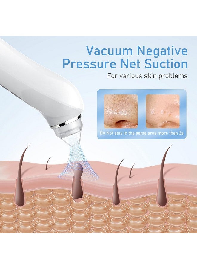 Ottleba Blackhead Remover Vacuum Usb Interface Type Pore Vacuum Black Head Extractions Tool With Camerafor Men And Women Pore Cleaner 3 Adjustment Modes & 6 Suction Heads(Light Pink)  - Image 3