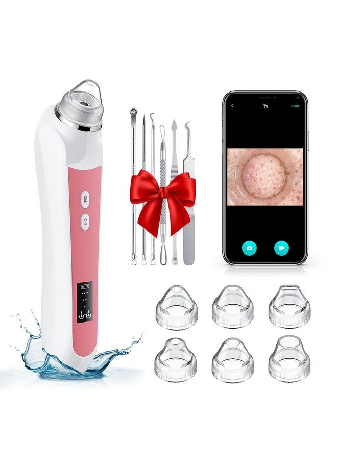 Ottleba Blackhead Remover Vacuum Usb Interface Type Pore Vacuum Black Head Extractions Tool With Camerafor Men And Women Pore Cleaner 3 Adjustment Modes & 6 Suction Heads(Light Pink)  - Image 1