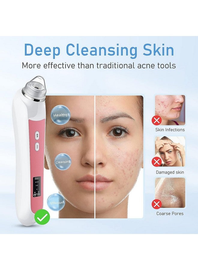 Ottleba Blackhead Remover Vacuum Usb Interface Type Pore Vacuum Black Head Extractions Tool With Camerafor Men And Women Pore Cleaner 3 Adjustment Modes & 6 Suction Heads(Light Pink)  - Image 4