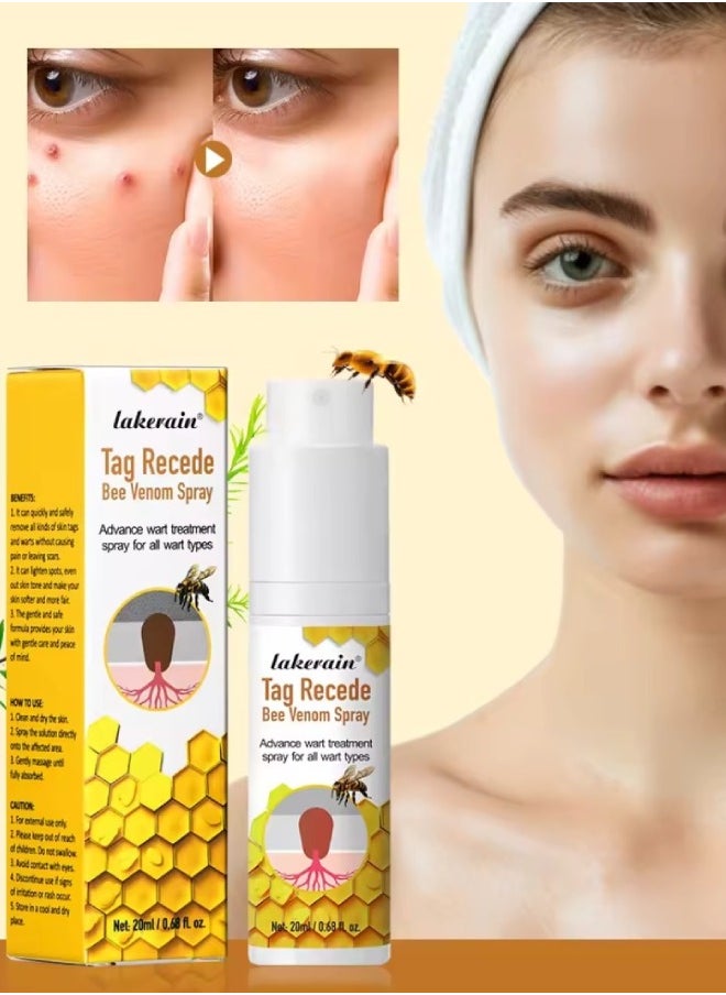 lakerain Tag Recede Bee Venom Spray Wart Treatment Spray Bee Venom Wart and Skin Tags Removal Treatment Spray Wart Remover Bee Venom Skin Tag Removal Spray Acne Removal Spray  - Image 1