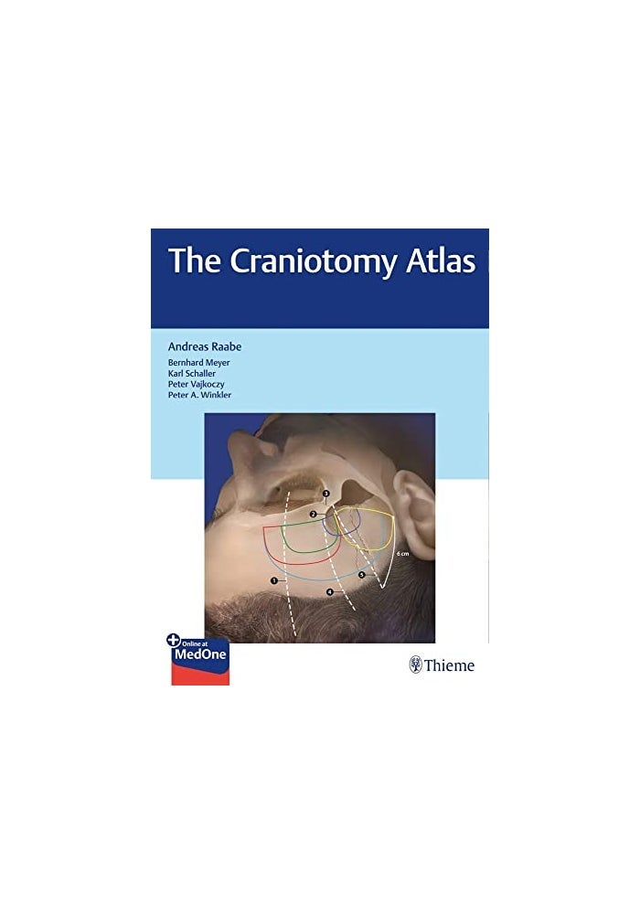 The Craniotomy Atlas