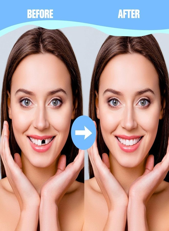 Treela 200 Pcs Fake Teeth for Missing Teeth Replacement Repair Kit Tooth Veneer Crown Replacement it Yourself Front Dental Veneer with Thermal Beads for Holiday Cosplay - Image 5