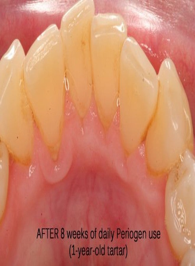 Periogen Complete Oral Health Rinse (3-PK) - Image 5