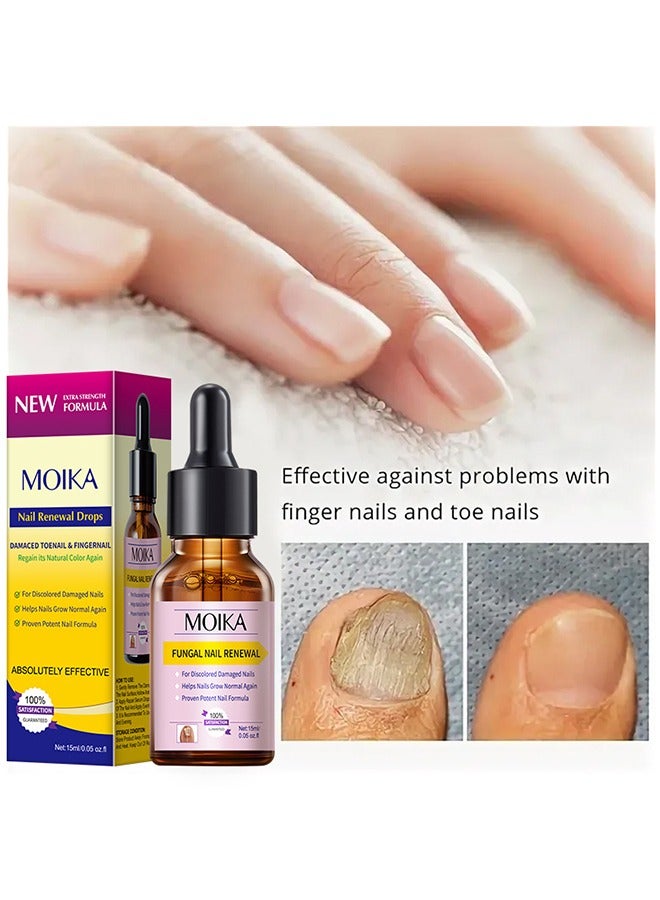 MOIKA Nail Renewal Drops - Extra Strength Toenail & Fingernail Repair Drops - Nail Care Renewal for Thick, Damaged & Discolored Nails,Toenail Fungus Treatment - Image 2