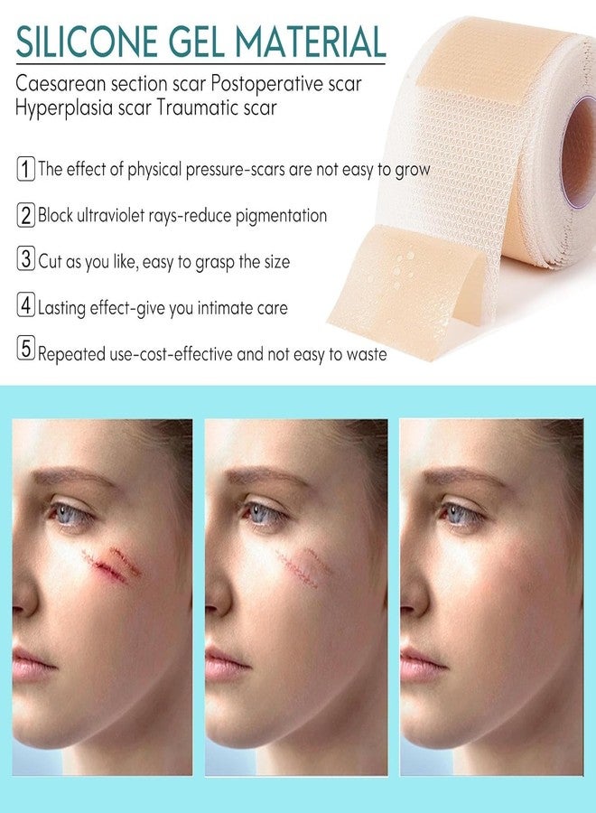 GKdared Scar Removal Tape Scar Removal Sheet Strips for C-Section, Acne Scars, Tummy Tuck, Keloid and Surgical Scars, Reusable Medical Grade Silicone Scar Tape, Get Scars Away Painless Reusable - Image 4