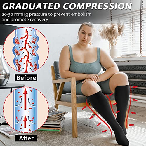 Ailaka Zipper Compression Socks for Men Women 2030 mmHg Close Toe Knee High Medical Compression Socks with Zipper Zip Up Socks for Varicose Veins Edema Recovery Pregnant Nurse - Image 3