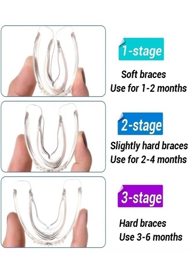 3pcs Mouth Guard for Grinding Teeth - pzsku/Z23D85E1A9A65942C11DAZ/45/_/1722257736/a7f0838a-f608-4298-9e46-ea5302b1dded