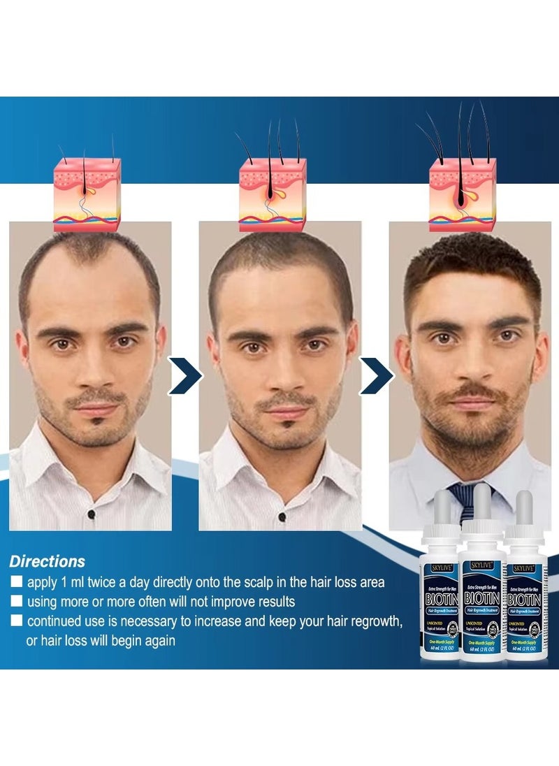 Kirkland Signature - 6-Piece Minoxidil Hair Regrowth Treatment(Packaging May Vary) - Image 1