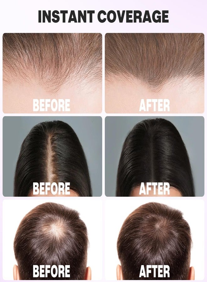 Acomler Instantly Root Cover Up Hairline Shadow Powder, Root Touch Up Hair Color 0.35 Ounce for Thinning Hair, Grey Hair Coverage, Hair Powder for Women Men, Beard Line, Bald Spots (Medium Brown) - Image 4